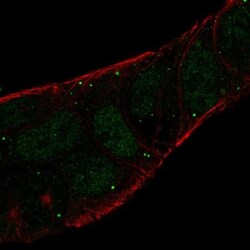 Legumain/Asparaginyl Endopeptidase Antibody, Novus Biologicals 0.1mL; Unlabeled:Antibodies,